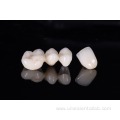 Zirconia bridge